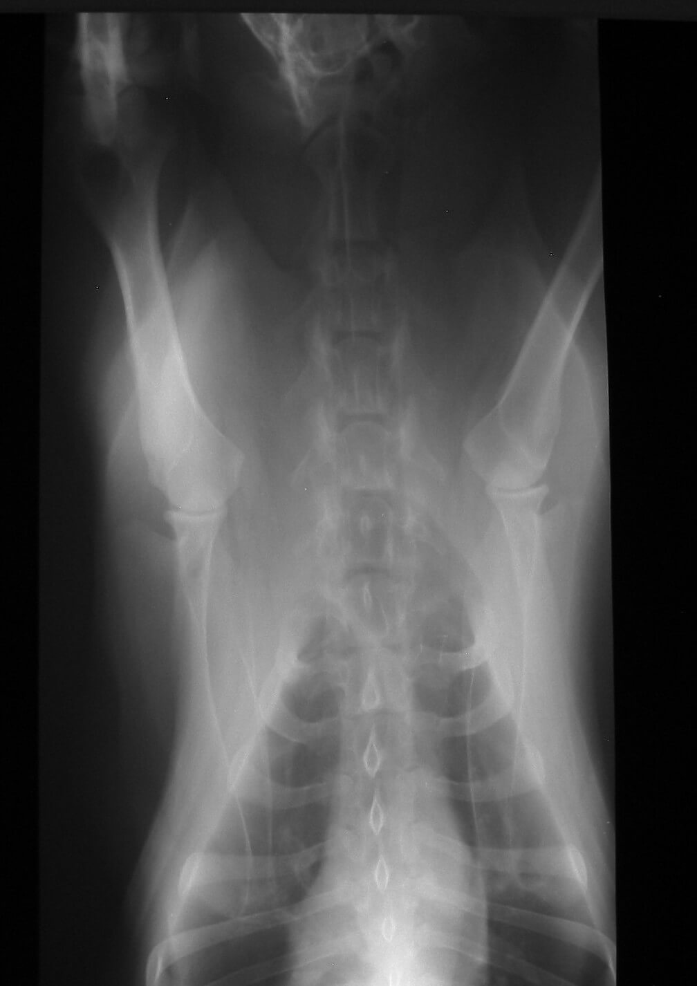 Xray